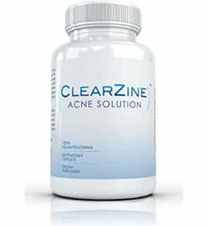 acnease vs clearzine