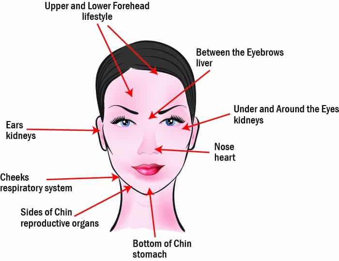 acne face map