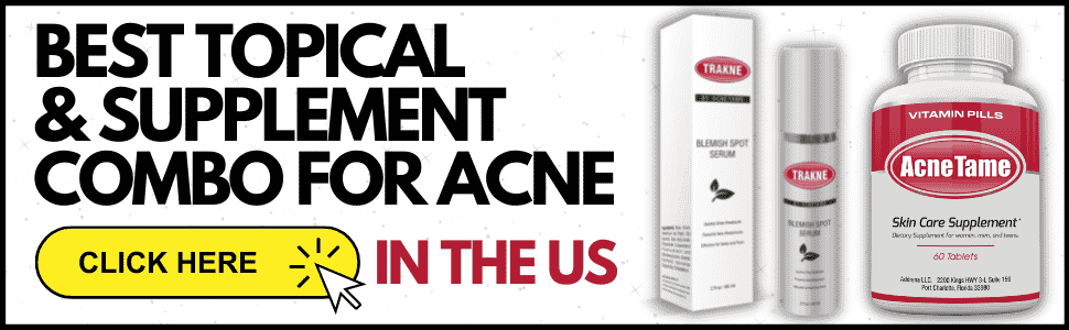 acne treatment amazon